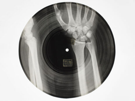 X-Ray and Music Record